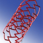 A fully expanded 3D model of a stent with a repeated "delta-wing" shape cell design. Image created in Tecplot 360 by Elazer Edelman, Vijaya Kolachalama, and Evan Levine.