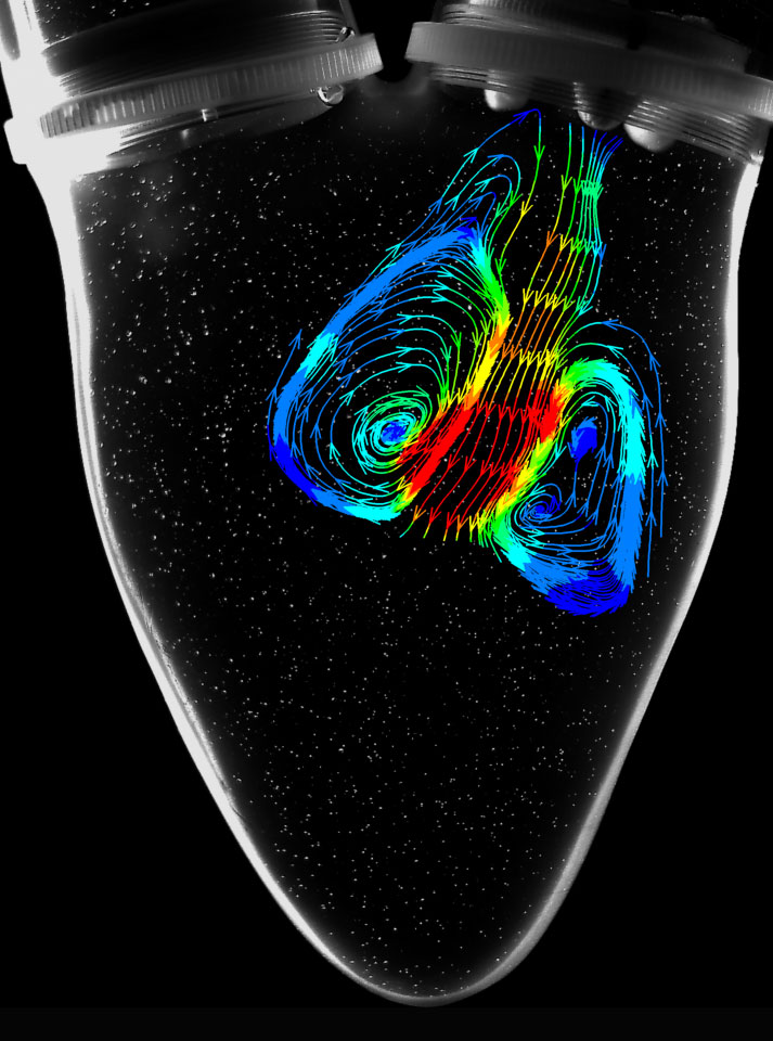 Bioprosthetic heart valves with CFD 